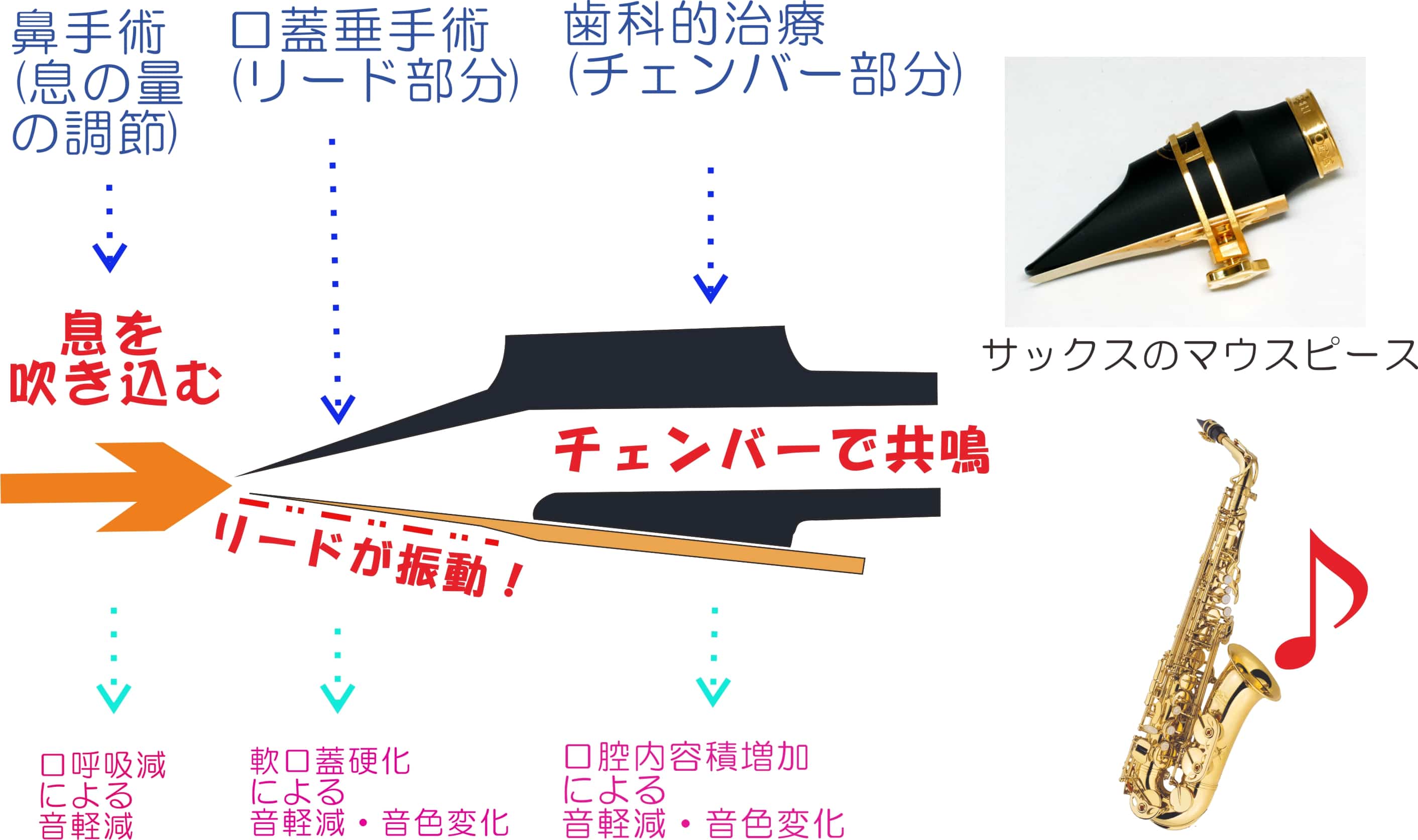 いびきの発生メカニズム