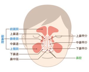 副鼻腔炎 蓄膿症 の手術 あさま耳鼻咽喉科